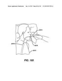 ADJUNCT MATERIALS AND METHODS OF USING SAME IN SURGICAL METHODS FOR TISSUE     SEALING diagram and image