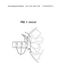 DEVICES AND METHODS FOR SEALING STAPLES IN TISSUE diagram and image