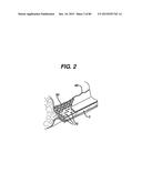 DEVICES AND METHODS FOR SEALING STAPLES IN TISSUE diagram and image