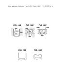 DEVICES AND METHODS FOR SEALING STAPLES IN TISSUE diagram and image