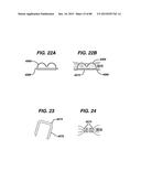 DEVICES AND METHODS FOR SEALING STAPLES IN TISSUE diagram and image