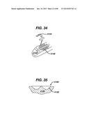 DEVICES AND METHODS FOR SEALING STAPLES IN TISSUE diagram and image