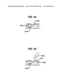 DEVICES AND METHODS FOR SEALING STAPLES IN TISSUE diagram and image