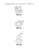 DEVICES AND METHODS FOR SEALING STAPLES IN TISSUE diagram and image