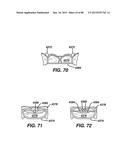 DEVICES AND METHODS FOR SEALING STAPLES IN TISSUE diagram and image