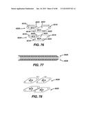 DEVICES AND METHODS FOR SEALING STAPLES IN TISSUE diagram and image