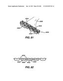 DEVICES AND METHODS FOR SEALING STAPLES IN TISSUE diagram and image