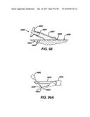 DEVICES AND METHODS FOR SEALING STAPLES IN TISSUE diagram and image