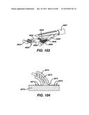 DEVICES AND METHODS FOR SEALING STAPLES IN TISSUE diagram and image