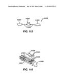 DEVICES AND METHODS FOR SEALING STAPLES IN TISSUE diagram and image