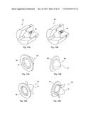 APPARATUS FOR DELIVERING FILAMENTARY MATERIAL INTO A PATIENT diagram and image