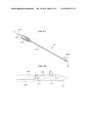 RETRO-CUTTING INSTRUMENT WITH ADJUSTABLE LIMIT SETTING diagram and image