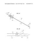 RETRO-CUTTING INSTRUMENT WITH ADJUSTABLE LIMIT SETTING diagram and image