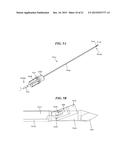 RETRO-CUTTING INSTRUMENT WITH ADJUSTABLE LIMIT SETTING diagram and image