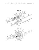 RETRO-CUTTING INSTRUMENT WITH ADJUSTABLE LIMIT SETTING diagram and image