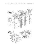 SOFT STABILIZATION ASSEMBLIES WITH OFF-SET CONNECTOR diagram and image