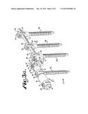 SOFT STABILIZATION ASSEMBLIES WITH OFF-SET CONNECTOR diagram and image