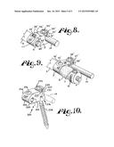 SOFT STABILIZATION ASSEMBLIES WITH OFF-SET CONNECTOR diagram and image