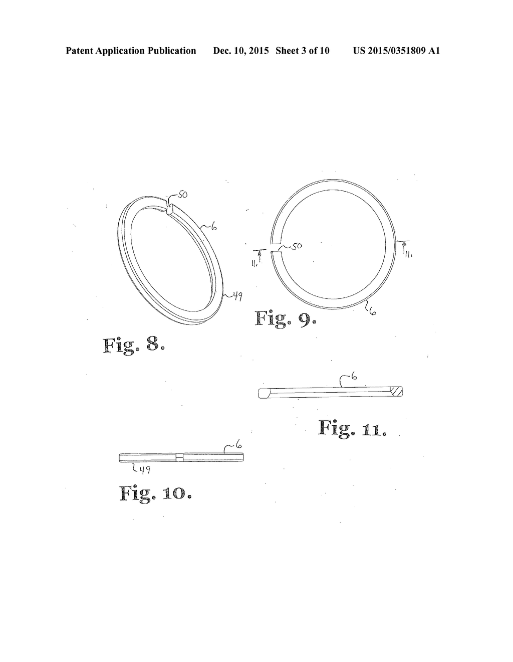 POLYAXIAL BONE ANCHOR WITH INSERT GUIDES - diagram, schematic, and image 04