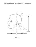 OCCIPITAL PLATE ASSEMBLIES WITH POLYAXIAL HEAD CONNECTORS diagram and image