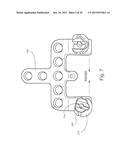 OCCIPITAL PLATE ASSEMBLIES WITH POLYAXIAL HEAD CONNECTORS diagram and image