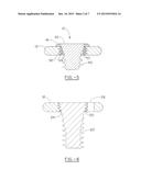 SYSTEM FOR ACHIEVING SELECTABLE FIXATION IN AN ORTHOPEDIC PLATE diagram and image