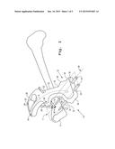 ORTHOPAEDIC AIMING DEVICE FOR COMPOUND SCREW TRAJECTORIES diagram and image