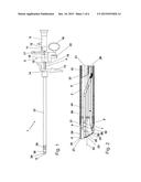 BIPOLAR RESECTOSCOPE diagram and image