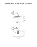 SYSTEM AND METHOD FOR MICROABLATION OF TISSUE diagram and image