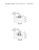 SYSTEM AND METHOD FOR MICROABLATION OF TISSUE diagram and image