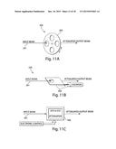 SYSTEM AND METHOD FOR MICROABLATION OF TISSUE diagram and image