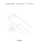 SURGICAL ALIGNMENT SYSTEM, APPARATUS AND METHOD OF USE diagram and image