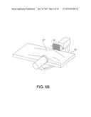 SURGICAL ALIGNMENT SYSTEM, APPARATUS AND METHOD OF USE diagram and image