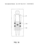 SURGICAL ALIGNMENT SYSTEM, APPARATUS AND METHOD OF USE diagram and image