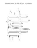 Parallel Alignment Apparatus for Facilitating Prosthodontic Restorations     and Method of Use diagram and image