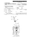 Dental Tool for Customizing Implants, System and Methods Thereof diagram and image