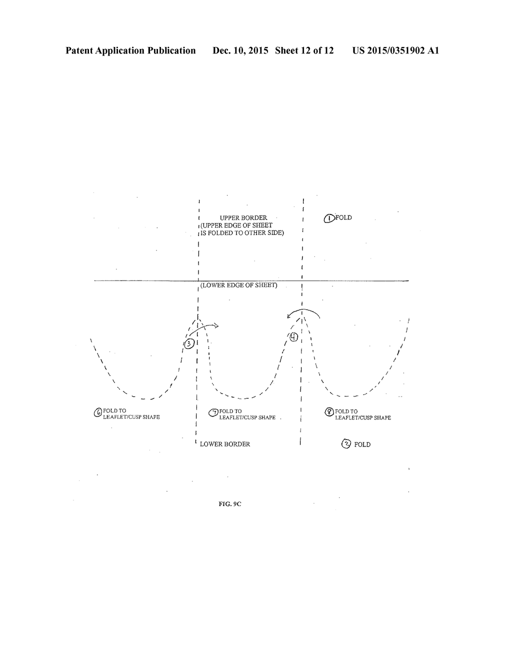 PERCUTANEOUSLY IMPLANTABLE REPLACEMENT HEART VALVE DEVICE AND METHOD OF     MAKING SAME - diagram, schematic, and image 13