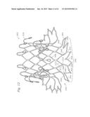 PROSTHETIC VALVE FOR REPLACING A MITRAL VALVE diagram and image