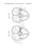 PROSTHETIC VALVE FOR REPLACING A MITRAL VALVE diagram and image