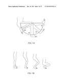 SYSTEMS AND METHODS FOR PROVIDING A FEMORAL COMPONENT diagram and image