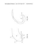 SYSTEMS AND METHODS FOR PROVIDING A FEMORAL COMPONENT diagram and image