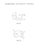 SYSTEMS AND METHODS FOR PROVIDING A FEMORAL COMPONENT diagram and image