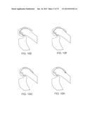 SYSTEMS AND METHODS FOR PROVIDING A FEMORAL COMPONENT diagram and image