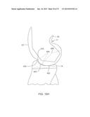 SYSTEMS AND METHODS FOR PROVIDING A FEMORAL COMPONENT diagram and image