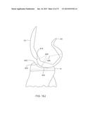 SYSTEMS AND METHODS FOR PROVIDING A FEMORAL COMPONENT diagram and image