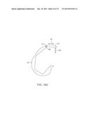 SYSTEMS AND METHODS FOR PROVIDING A FEMORAL COMPONENT diagram and image