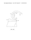 SYSTEMS AND METHODS FOR PROVIDING A FEMORAL COMPONENT diagram and image