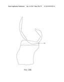 SYSTEMS AND METHODS FOR PROVIDING A FEMORAL COMPONENT diagram and image