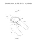 SYSTEMS AND METHODS FOR PROVIDING A FEMORAL COMPONENT diagram and image