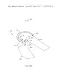 SYSTEMS AND METHODS FOR PROVIDING A FEMORAL COMPONENT diagram and image